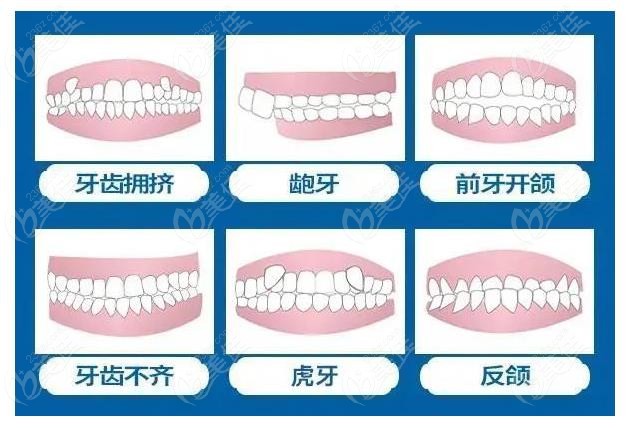 成都高德口腔做牙齿矫正怎么样