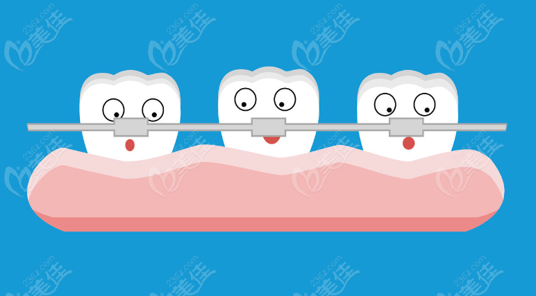 牙齿局部矫正和全部矫正的区别